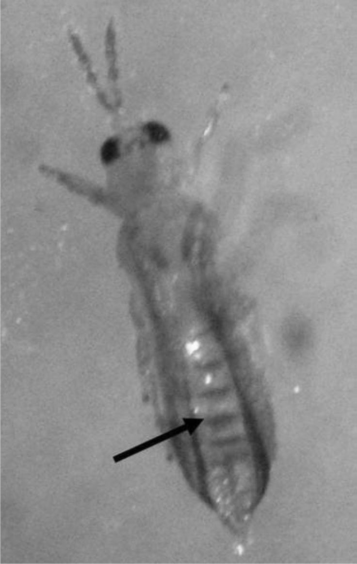 Crestas antero-costales transversas en los tergitos abdominales.
