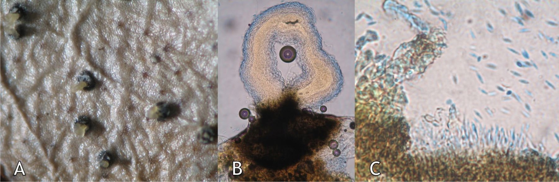 Phomopsis eucaliptii. A: picnidios con cirros sobre superficie foliar, B: picnidio con cirro de α-conidios al microscopio óptico (40x) y C: conidios y células conidiógenas.