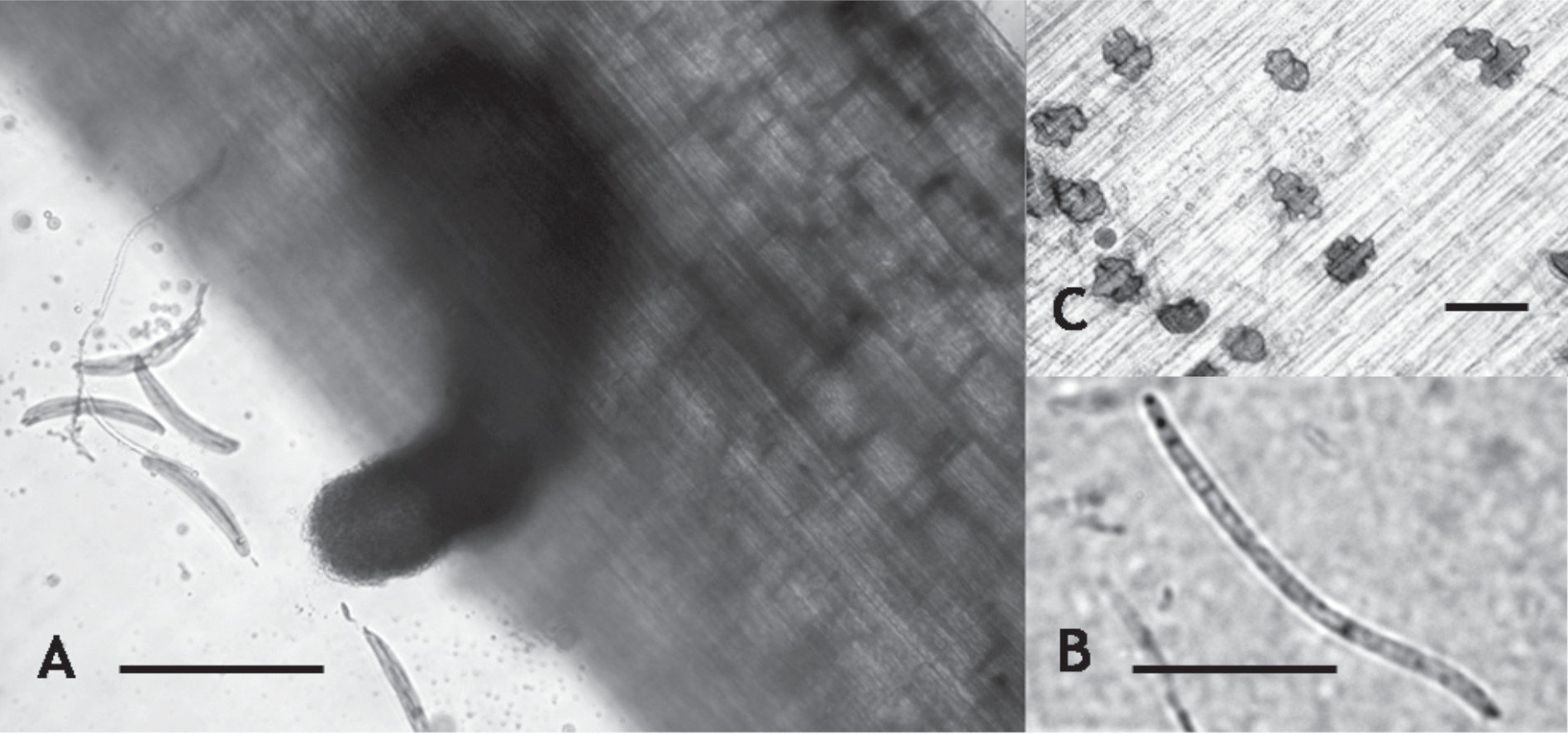 Gaeumannomyces graminis var. graminis. A-Peritecio (barra = 150 µm) y ascas (barra = 150 µm), B-Ascosporas (barra = 50 µm), C-hifopodios (barra = 25 µm).