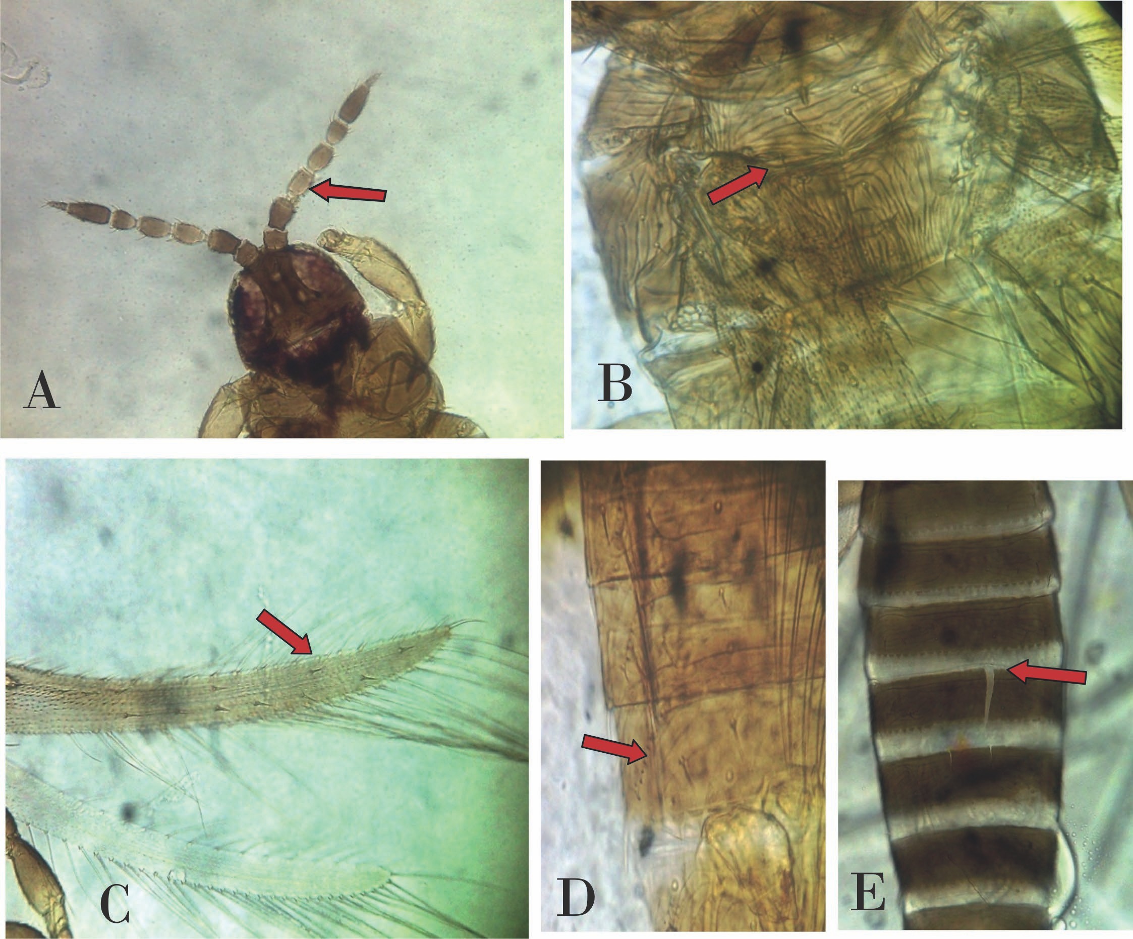 Caracteres taxonómicos de Microcephalotrips abdominalis. A. Cabeza más pequeña que el pronotum, antena de VII segmentos y III- IV de color más claro. B. Escultura del metanotum lineal y convergente en la parte posterior. C. Alas con dos setas distales en la vena principal. D. Ctenidias en terguitos V-VIII. E. Terguitos abdominales con craspedum.