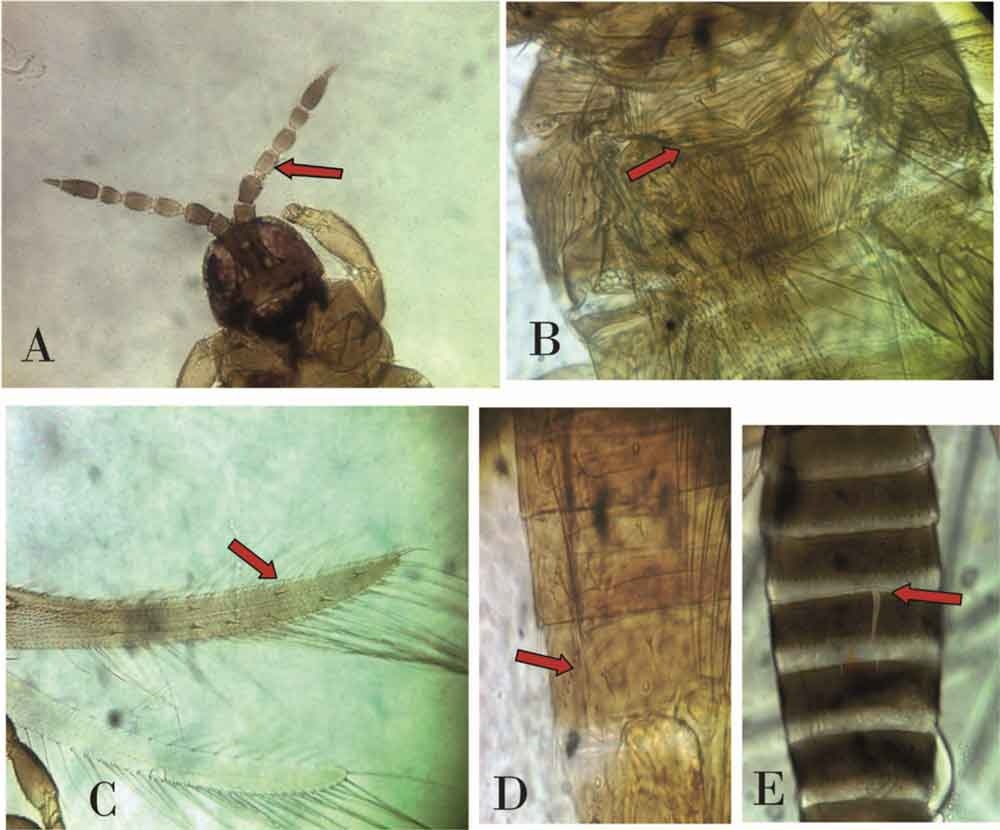 Caracteres taxonómicos de Microcephalotrips abdominalis. A. Cabeza más pequeña que el pronotum, antena de VII segmentos y III- IV de color más claro. B. Escultura del metanotum lineal y convergente en la parte posterior. C. Alas con dos setas distales en la vena principal. D. Ctenidias en terguitos V-VIII. E. Terguitos abdominales con craspedum.