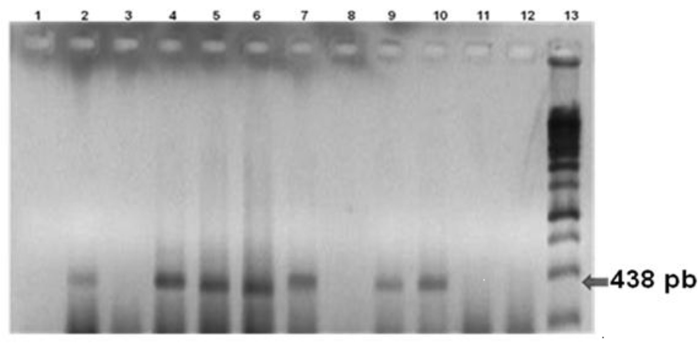 Electroforesis en gel de agarosa al 0,8 % de los productos de la amplificación de la Reacción en Cadena de la Polimerasa de L. xyli en jugos de caña de azúcar. Línea 1: control negativo; línea 2: cultivar CP31-294; línea 3: cultivar My5514; línea 4: cultivar C86-56; línea 5: cultivar C87-51; línea 6: cultivar C88-380; línea 7: cultivar C90-469; línea 8: cultivar C132-81; línea 9: cultivar CP52-43; línea 10: cultivar SP70-1284; línea 11: cultivar C85-102; línea 12: cultivar C86-531; línea 13: marcador de peso molecular (1 kb, Promega).